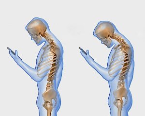 Texting-Posture-Back-Pain-Problem