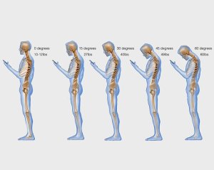 Texting-Posture-Back-Pain2